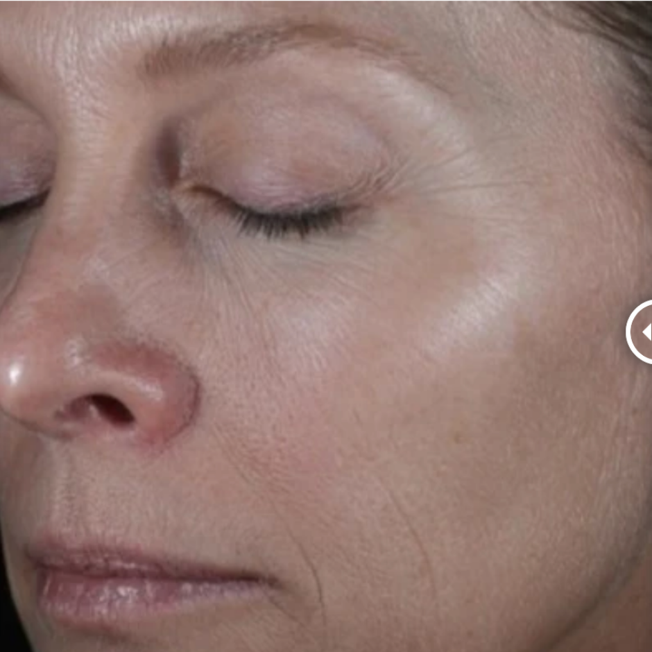 ReSURFACE Skin Polish