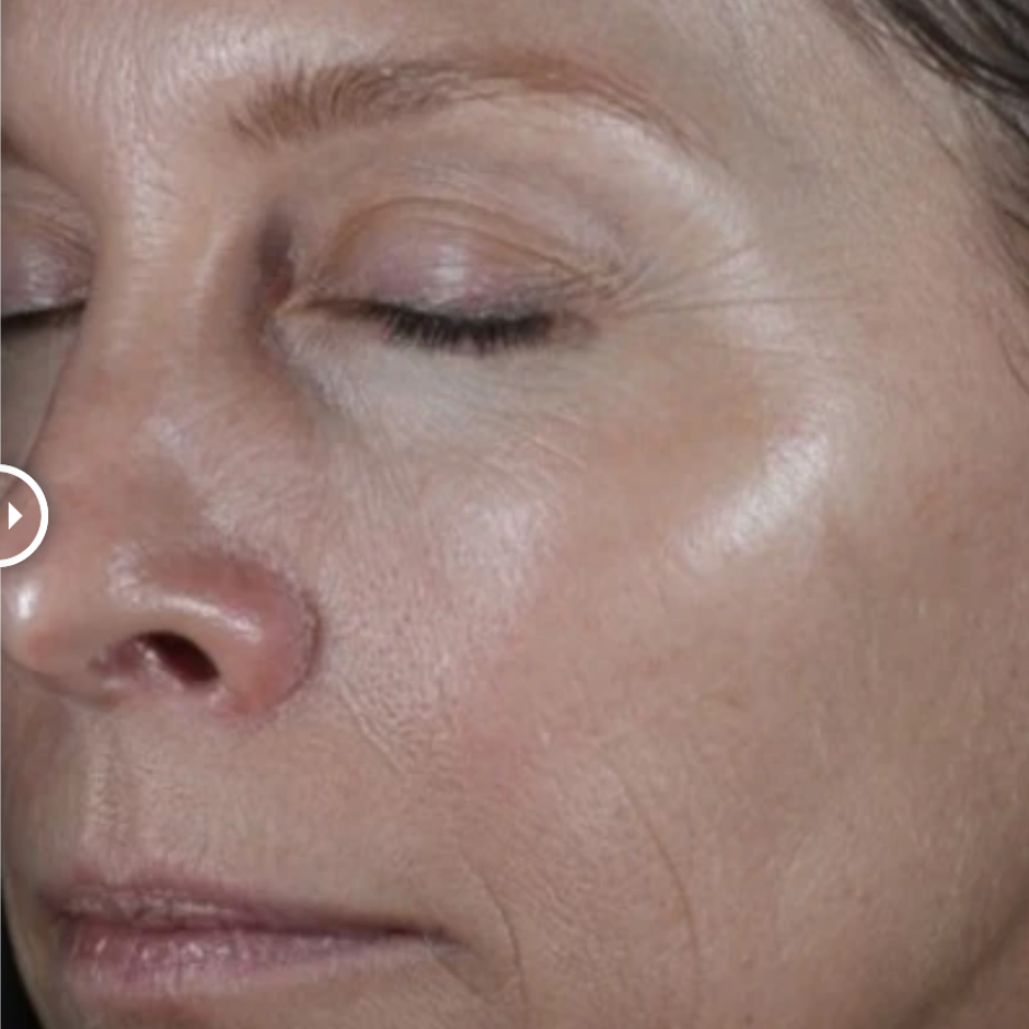 ReSURFACE Skin Polish