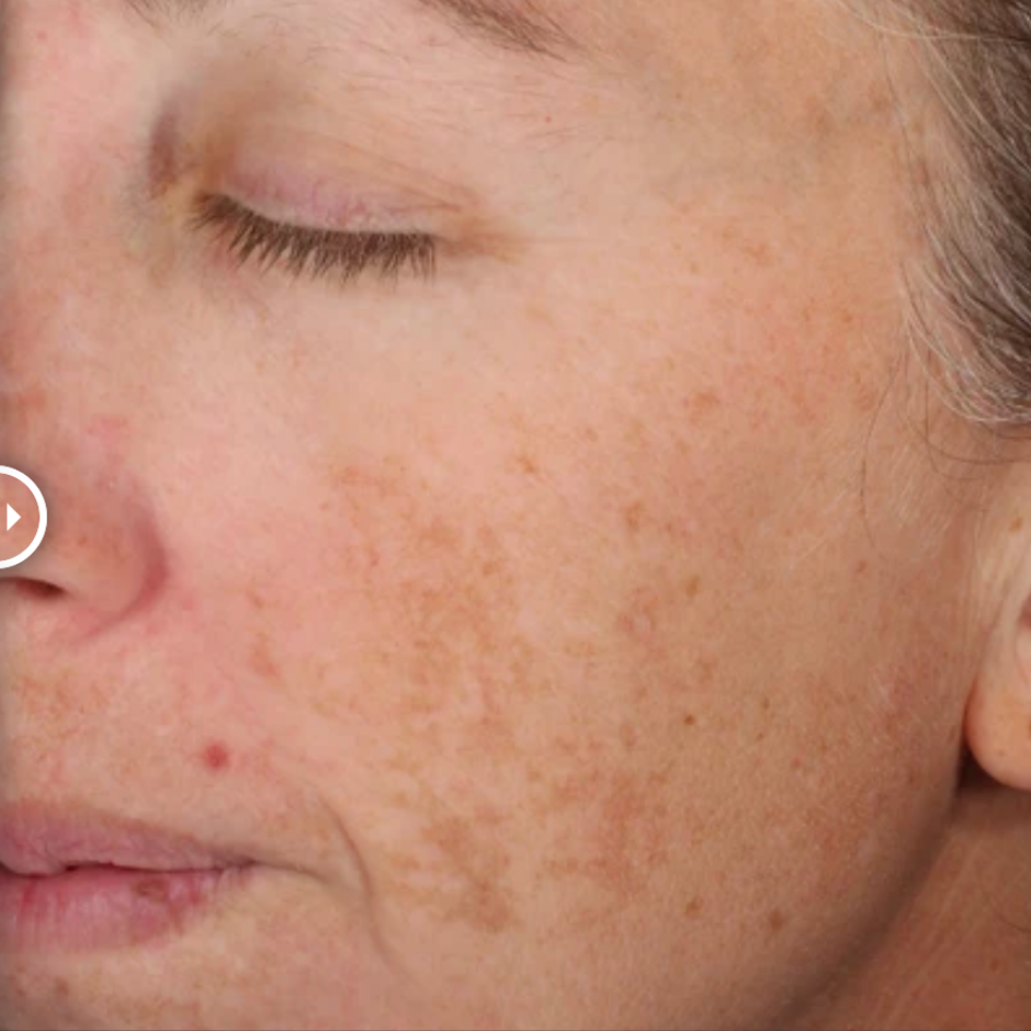 A-LUMINATE Brightening Serum™