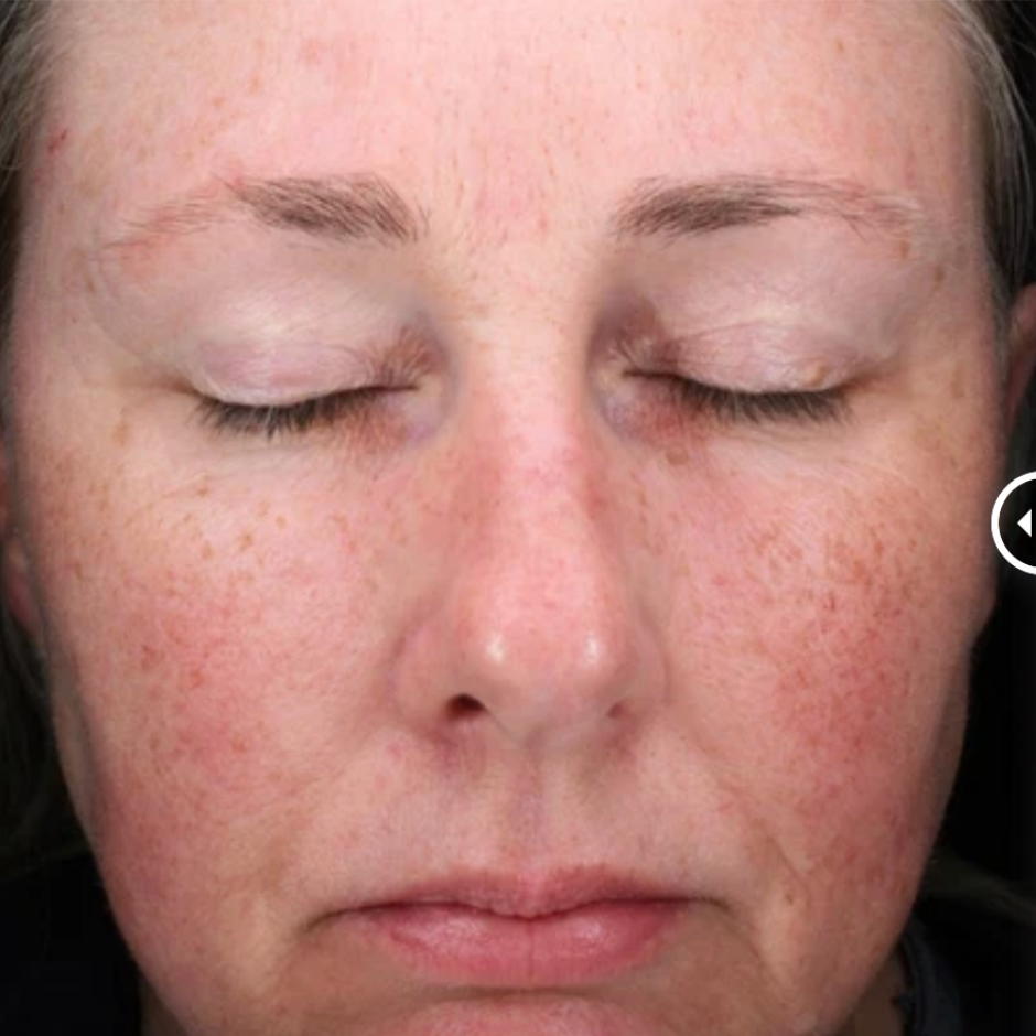 C-RADICAL Defense Antioxidant Serum