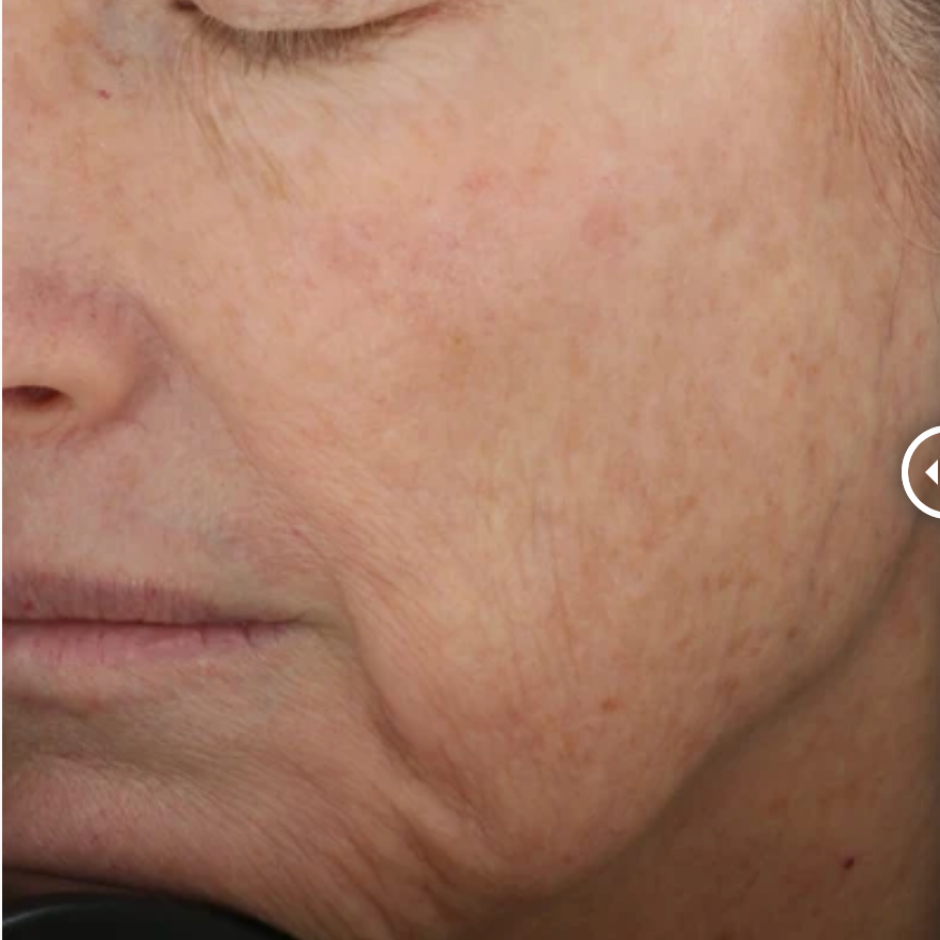 Restorative Skin Complex with TriHex+™