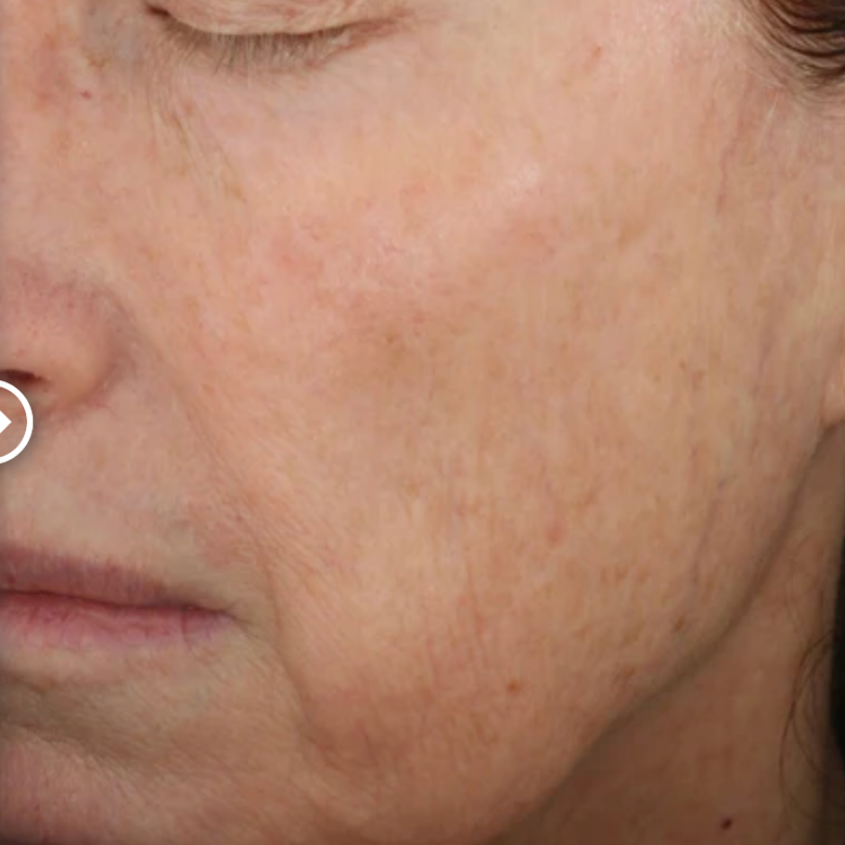 Restorative Skin Complex with TriHex+™