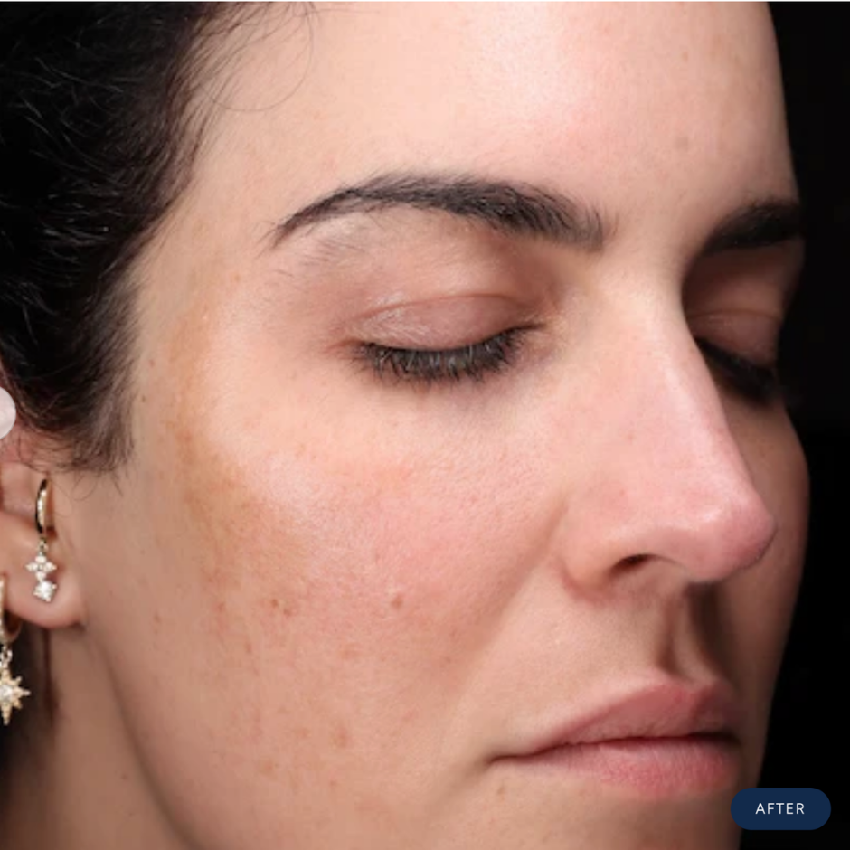 CÉLTHERA Advanced Overnight Repair Cream