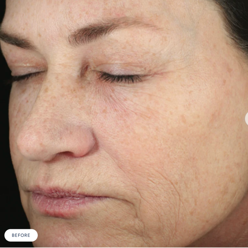RetaXome Daily Retinal Hydrator