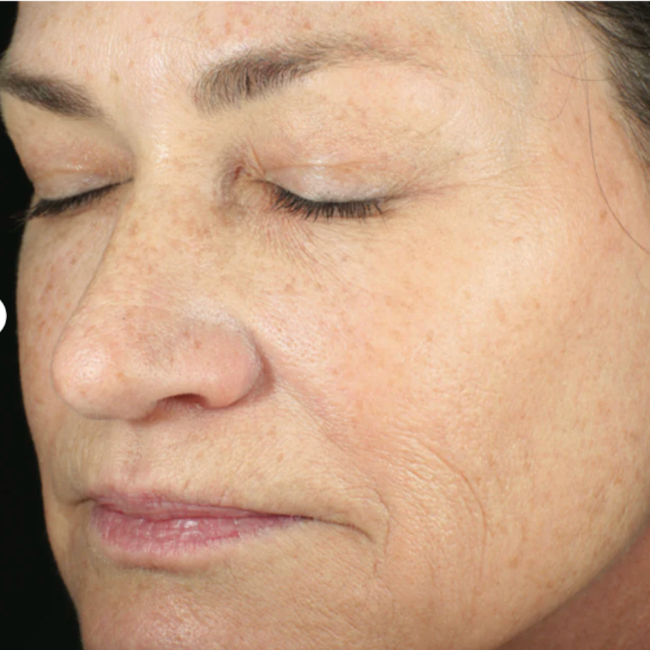 RetaXome Daily Retinal Hydrator