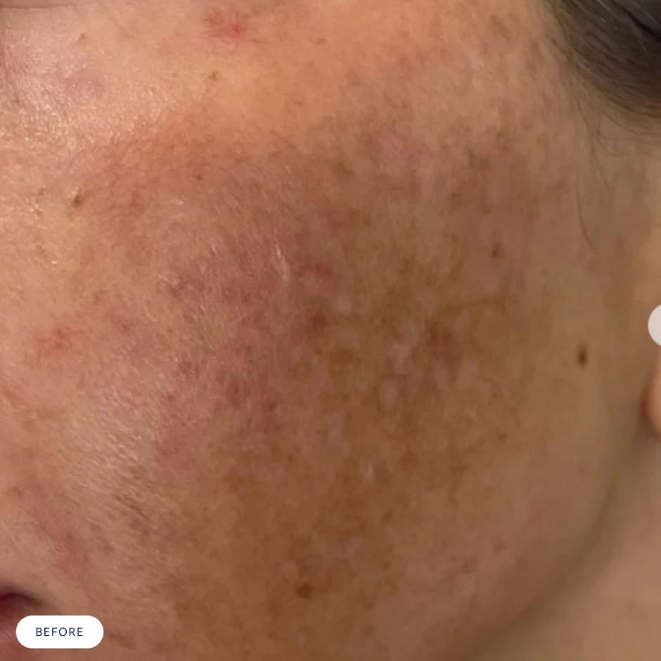 VIVID Brightening Serum