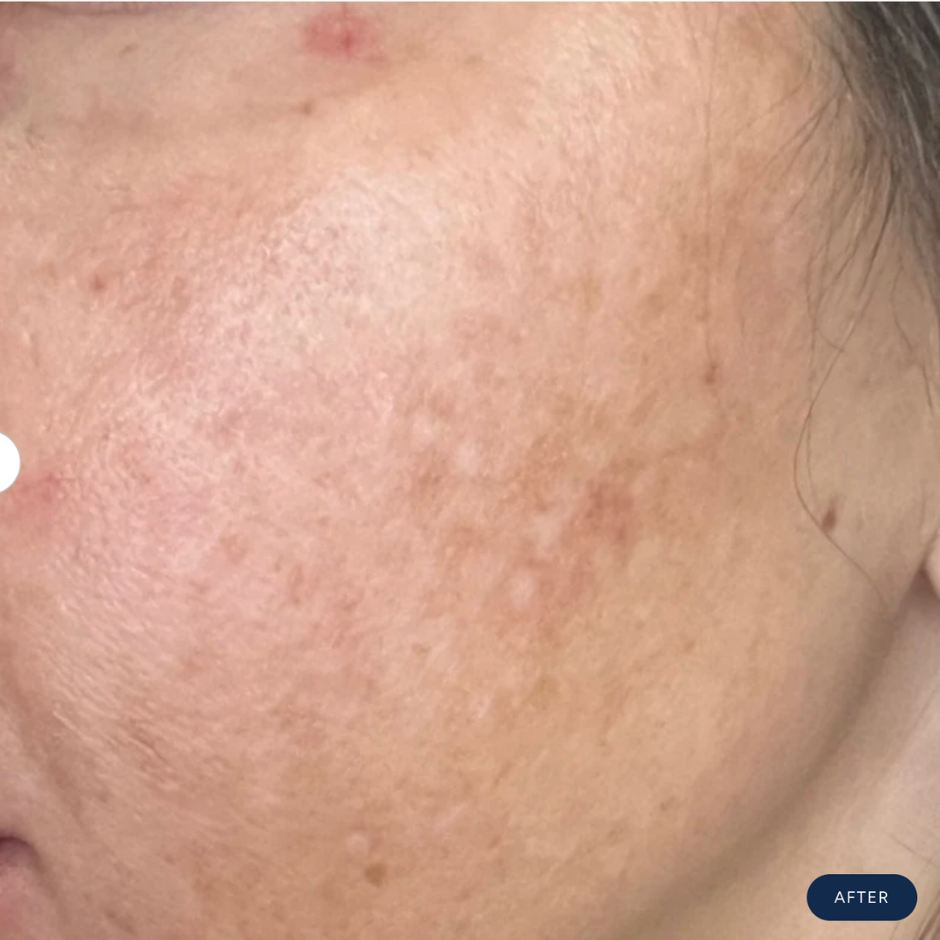 VIVID Brightening Serum