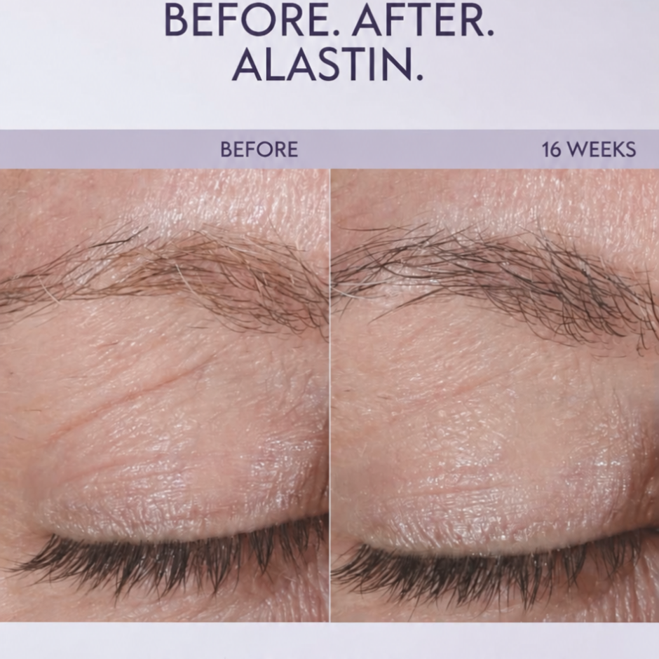 Restorative Eye Complex with TriHex Technology®